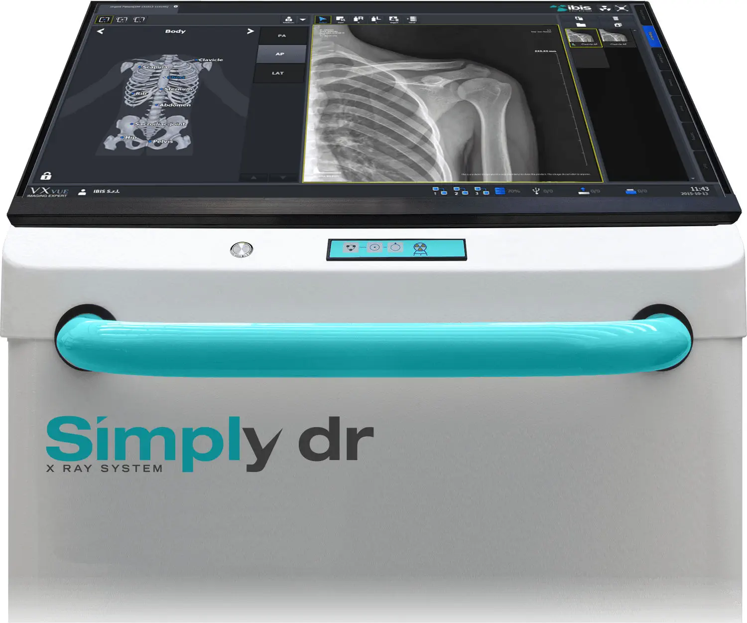 Digital mobile radiography unit - Simply dr - IBIS X Ray Systems