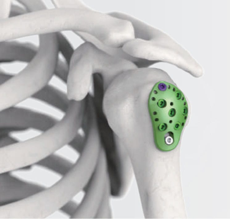 Humerus compression plate ARIX 3.5 Jeil Medical Corporation