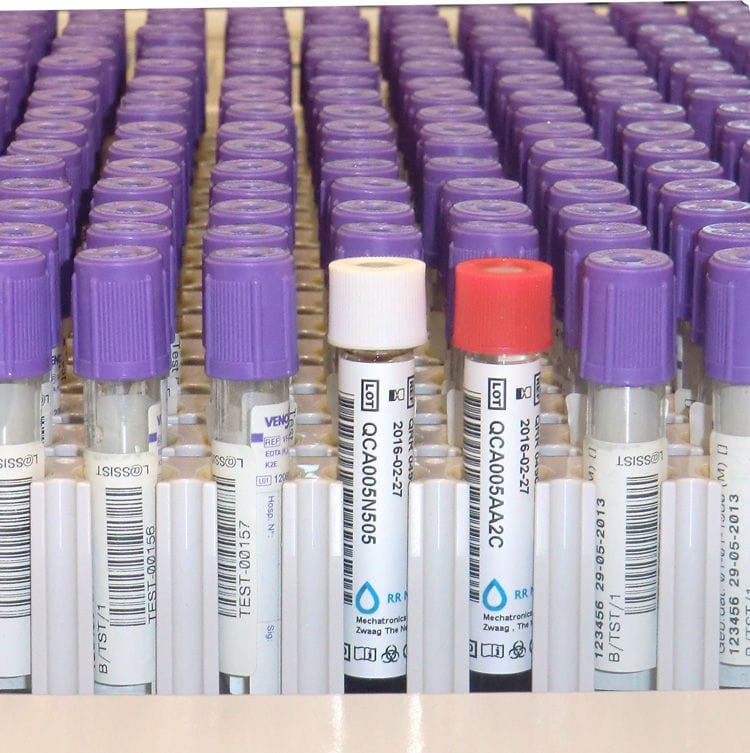 Quality control reagent - Starrsed - Mechatronics Instruments - ESR ...