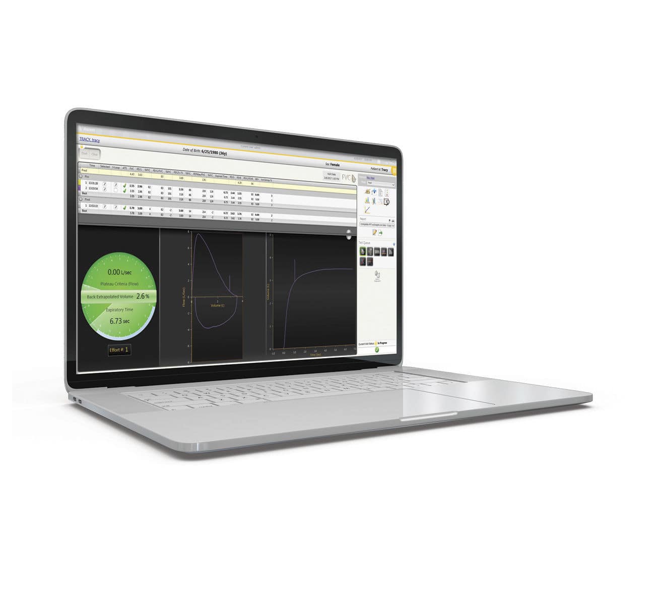 Stress test software Ascent™ MGC Diagnostics management / control