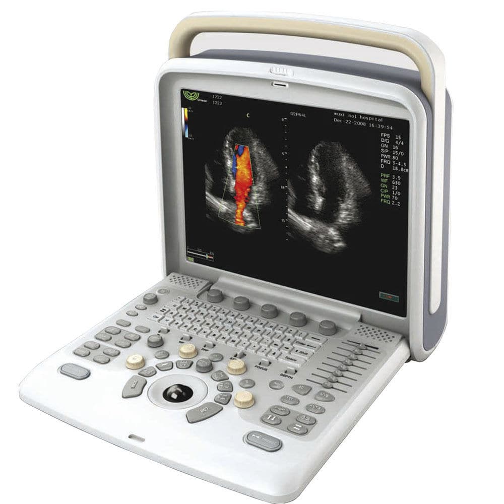 Portable Ultrasound System - Q5 - Medgyn Products - For Gynecological ...