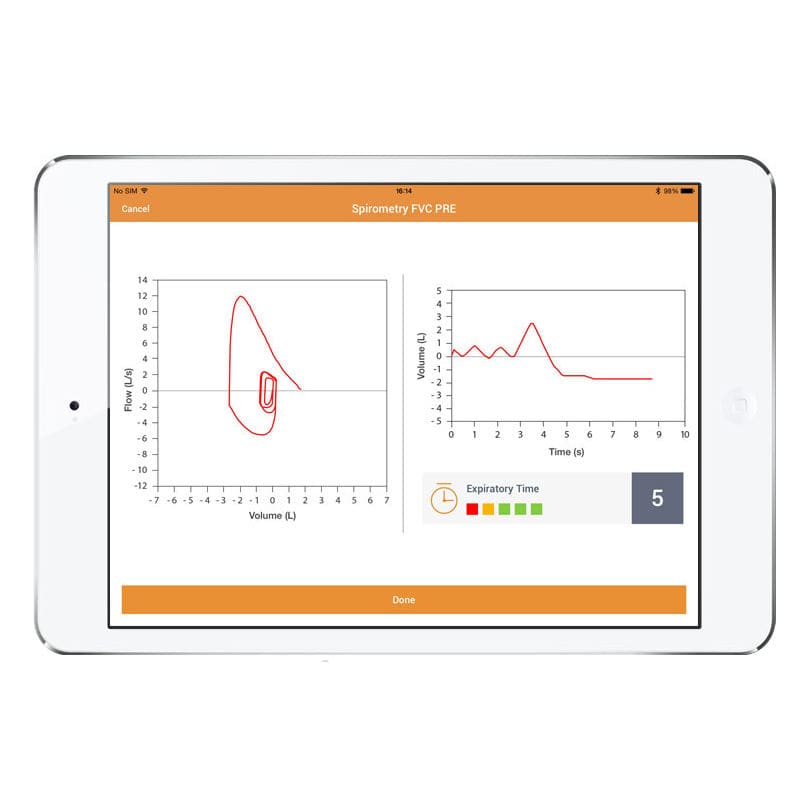 Spirometry iOS application MIR Spiro App MIR Medical