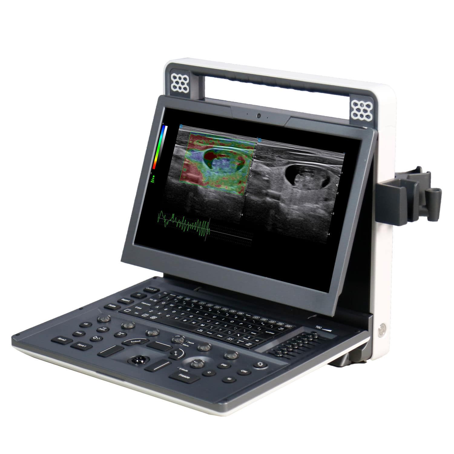 Portable Ultrasound System Apogee C2 Siui For Multipurpose Ultrasound Imaging For 2483