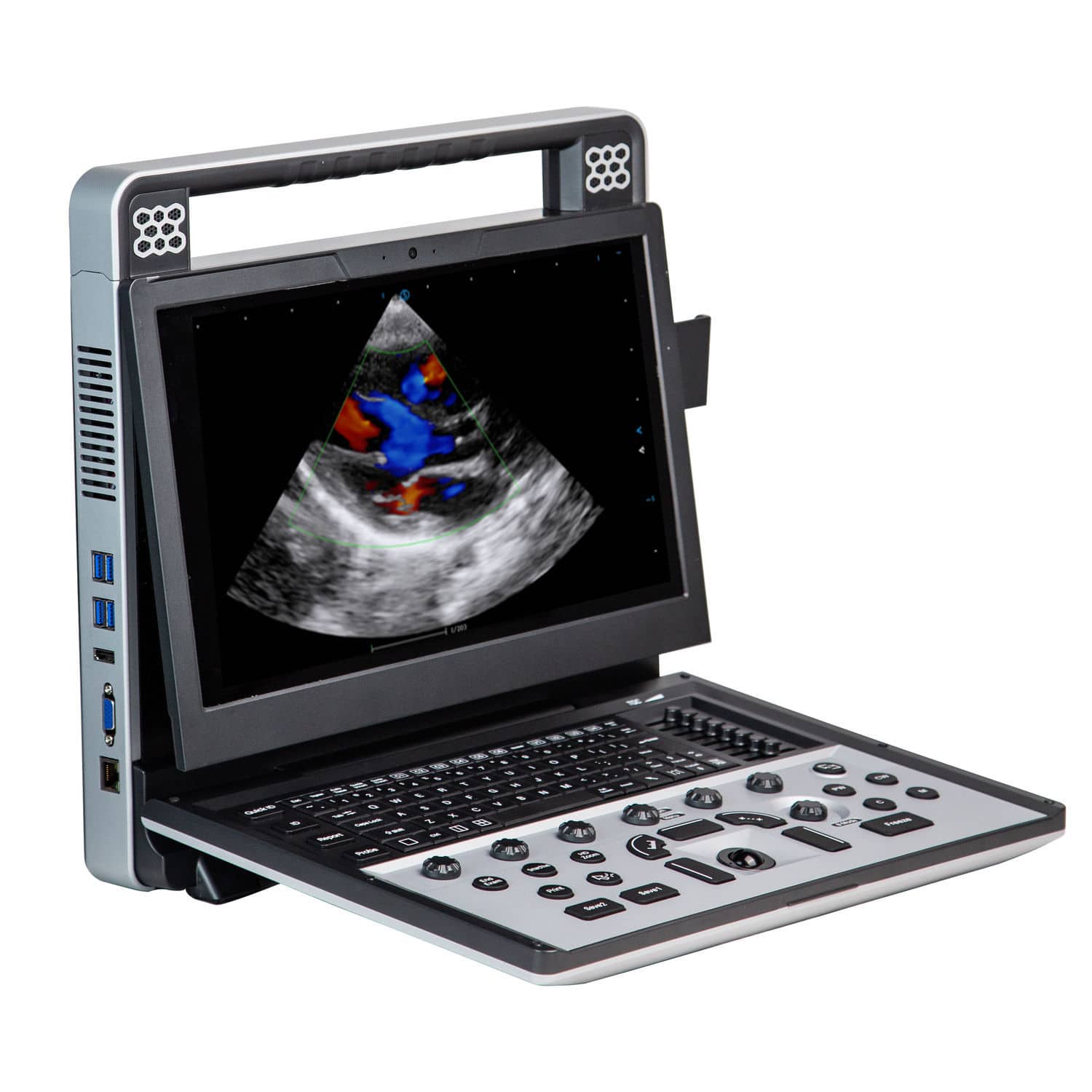 Portable ultrasound system - Apogee C5 - SIUI - for multipurpose ...