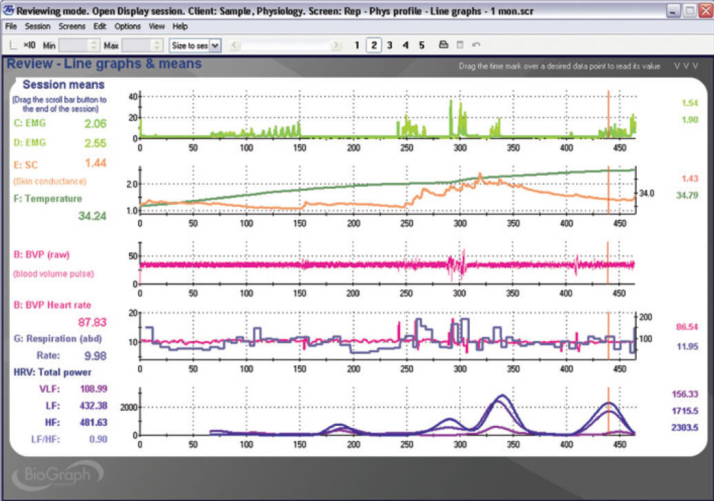 biograph infiniti software