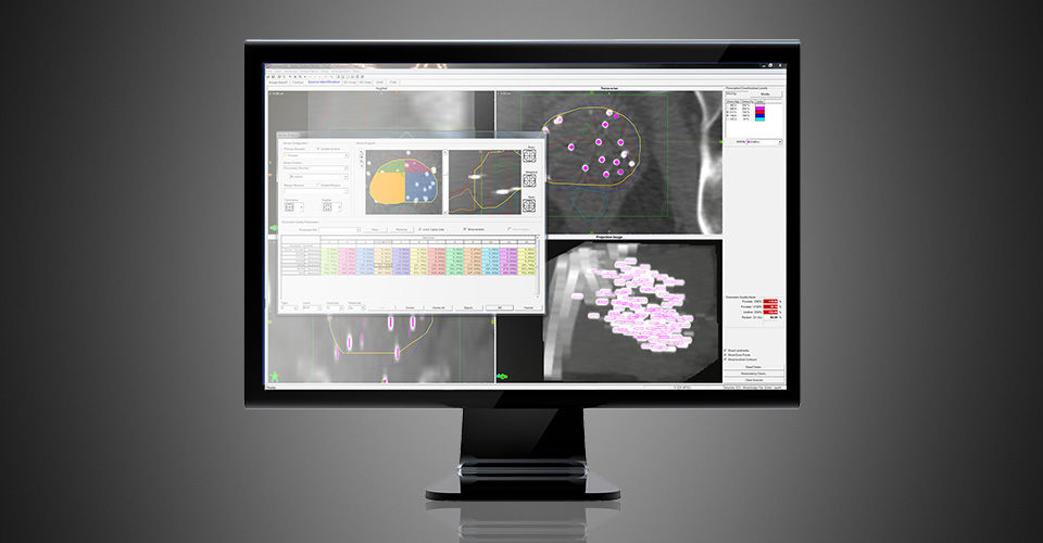 Visualization software VariSeed™ Varian Oncology planning / import / for brachytherapy