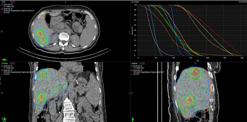 Medical software RapidSphere Varian Oncology oncology / treatment / modeling
