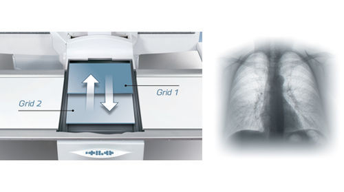 Canon Medical Streamlines Fluoroscopy And Radiography Exams With