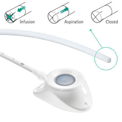 Implantable venous port / single-lumen / polymer - Celsite® Valved ...