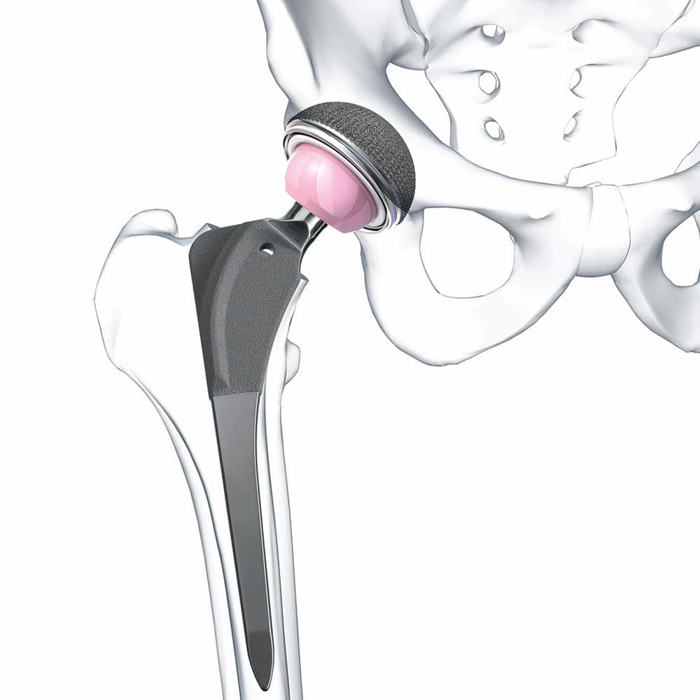 Primary hip prosthesis - Bicontact® - Aesculap® - cemented or non-cemented