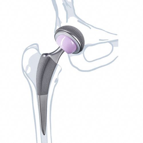 Primary hip prosthesis Excia® T Aesculap® cemented or noncemented