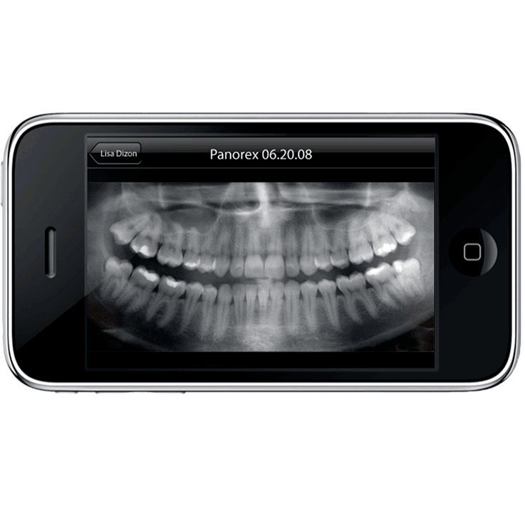 Clinical software module Pearl Carestream Dental dental / for