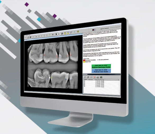Caries detection software Logicon Carestream Dental for dental