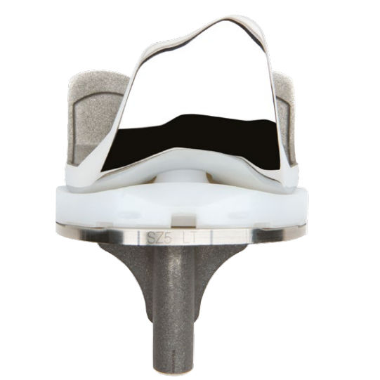 Total knee prosthesis ANTHEM™ Smith & Nephew fixedbearing / cemented