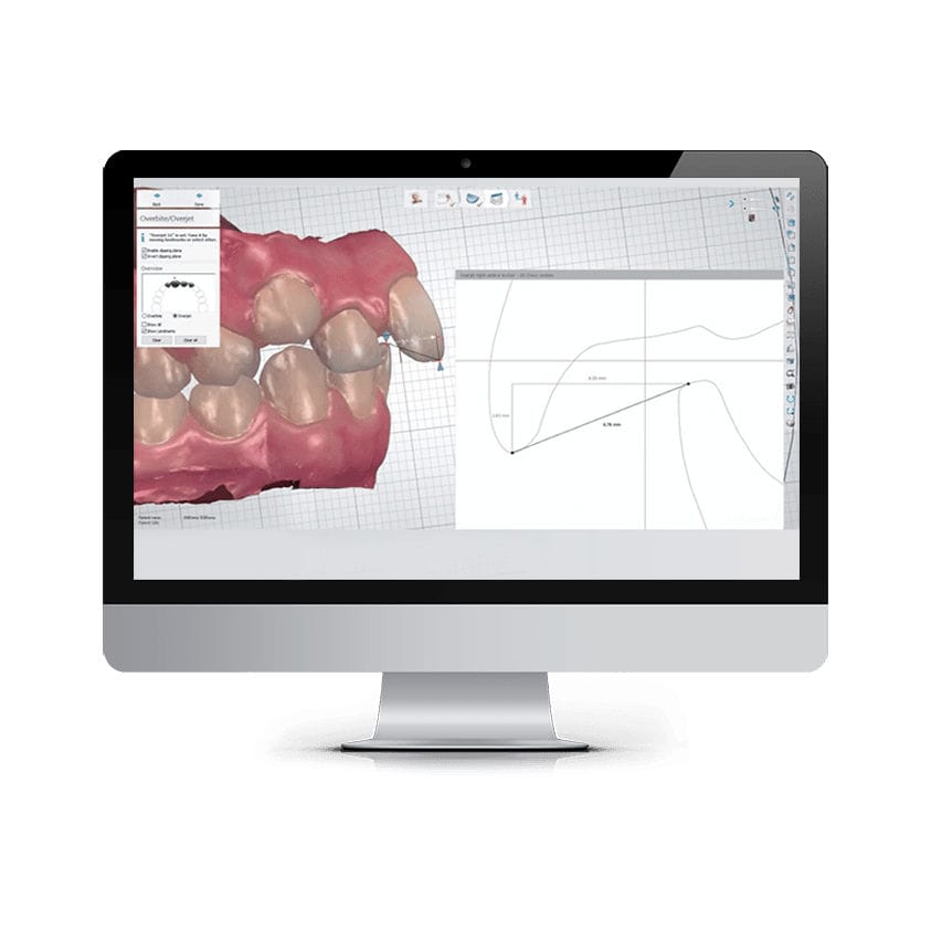 Orthodontic software ALIGNER STUDIO 3shape analysis / management