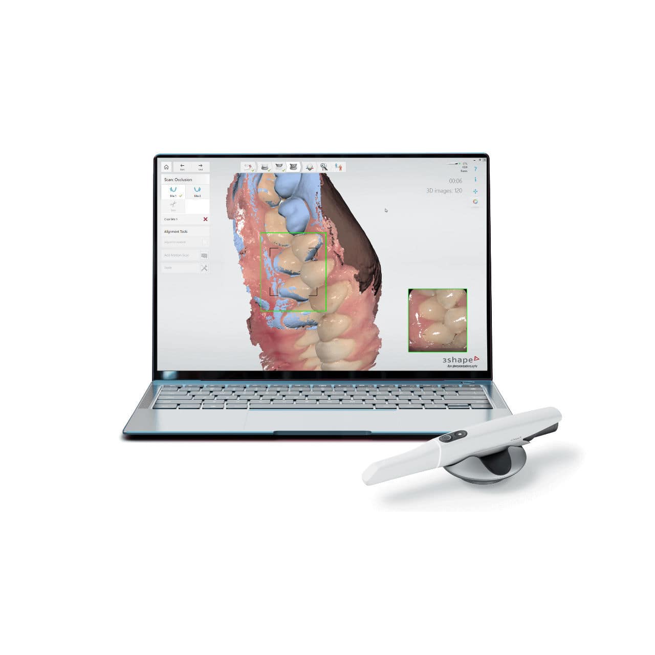 Medical software - Unite - 3shape - clinical / laboratory / dental