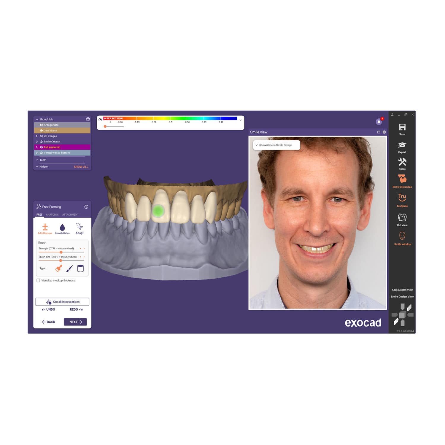 Medical software ChairsideCAD exocad GmbH clinical / for dental