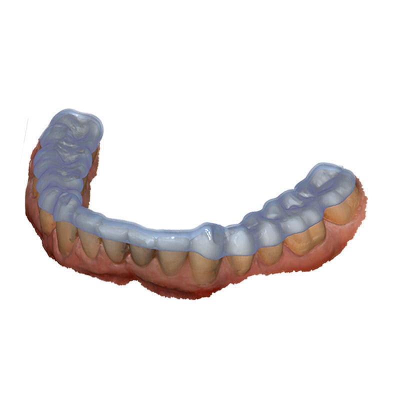 Design software module - Bite Splint - exocad GmbH - dental / joint