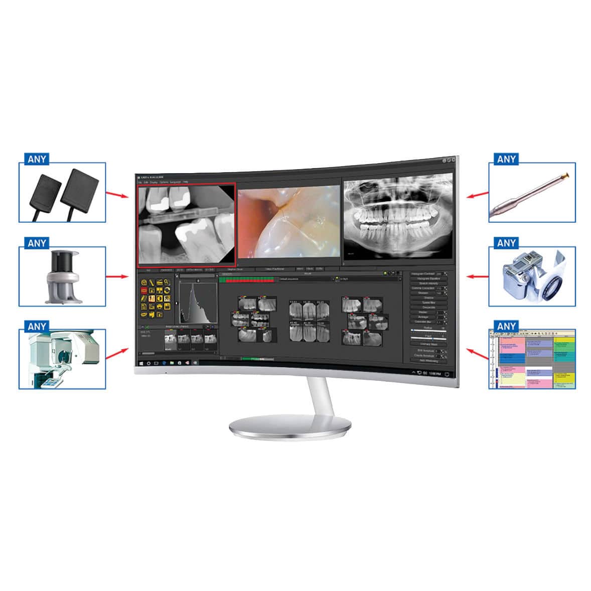 Orthodontic software Mediadent v8 IMAGELEVEL for dental imaging