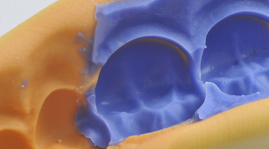 Silicone dental material ventura top MADESPA S.A. for impression