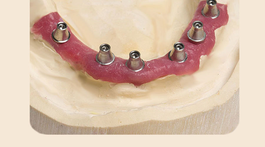 Casting dental material ventura implant stone HG MADESPA S.A. for