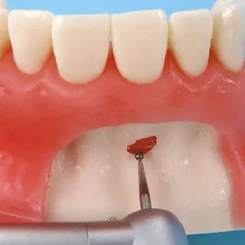 NISSIN 顎模型 SRP実習用 D16FE-500HPRO-S1A1-GSE Nissin Study Model Archives - New Citizens Dental Supply and