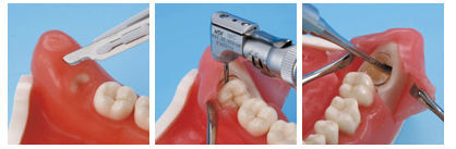 その他 NISSIN DENTAL MODEL Standard Teeth Model (nissin) /Dental Model - Teeth Model