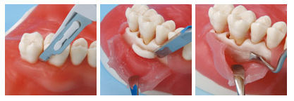 その他 NISSIN DENTAL MODEL TOOTH ANATOMY (ANA) | STUDY MODEL WITH REMOVABLE TEETH