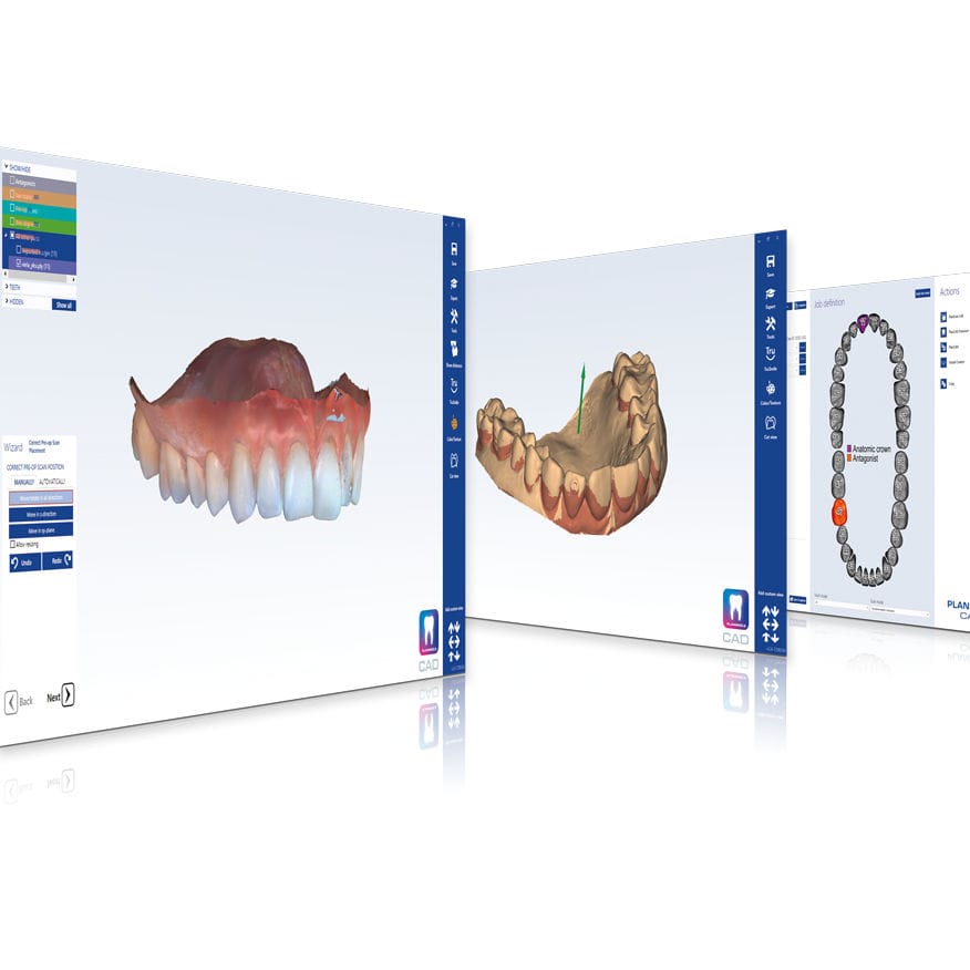 CAD software - PlanCAD® Premium - Planmeca - for dental prosthesis ...