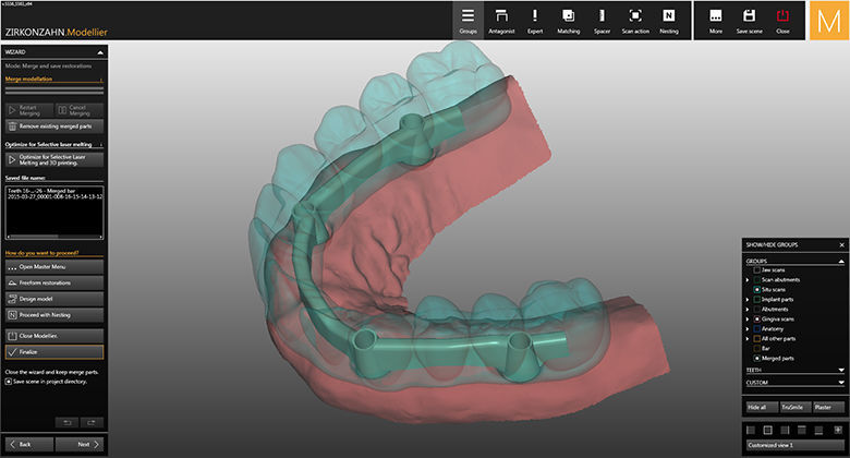 Dental prosthesis design software - SY0380 - Zirkonzahn - CAM / CAD ...