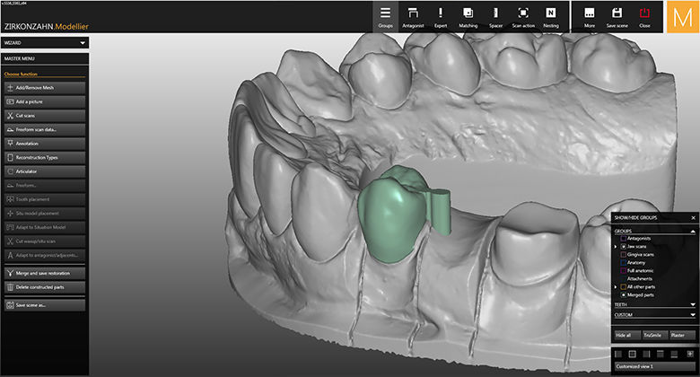 Dental prosthesis design software - SY0350 - Zirkonzahn - CAM / CAD ...