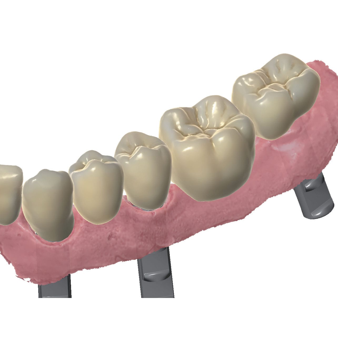 CAM software - Prettau® (fully anatomic) - Zirkonzahn - CAD / for ...