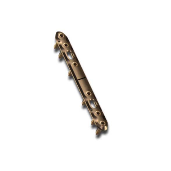 Radius compression plate - ChM - ulna / locking / titanium