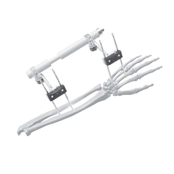 wrist-external-fixation-system-206315-sofemed-international