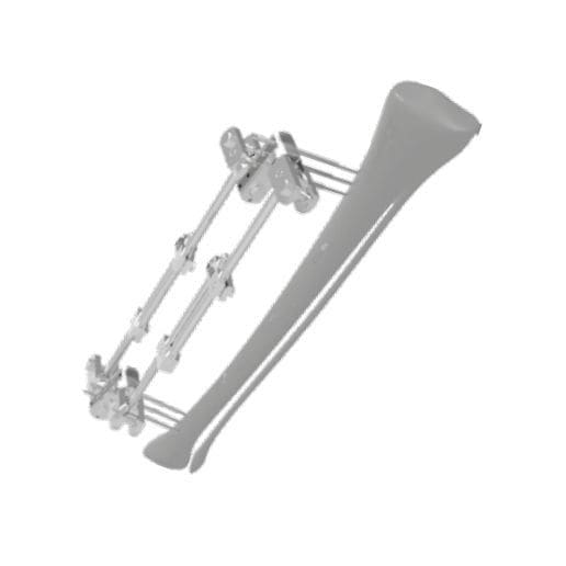Tibia external fixation system - 201523 - SOFEMED International ...
