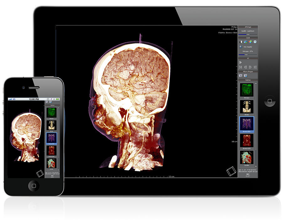 Medical imaging software Evolucare Imaging Diffusion (Sharing