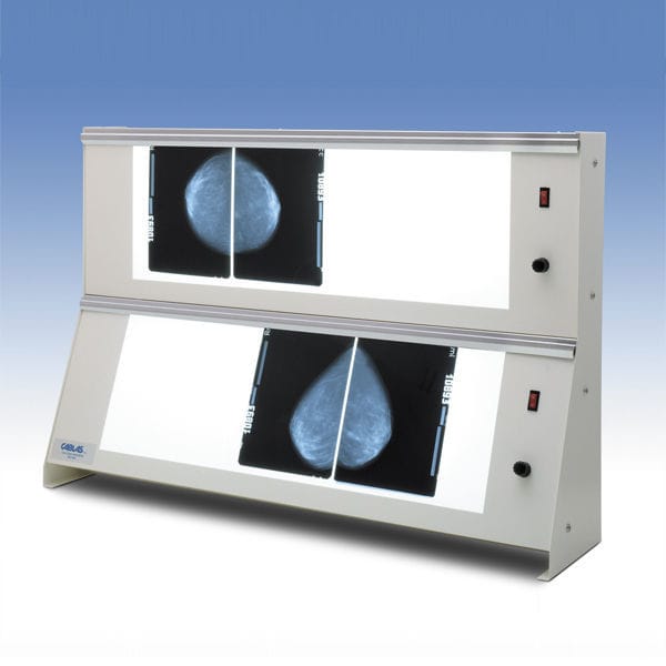 2screen Xray film viewer 72 X 24 X 2 / 96 X 30 X 2 Cablas for