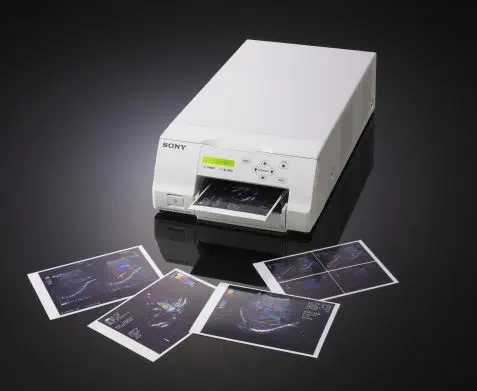 sony dye sublimation printer