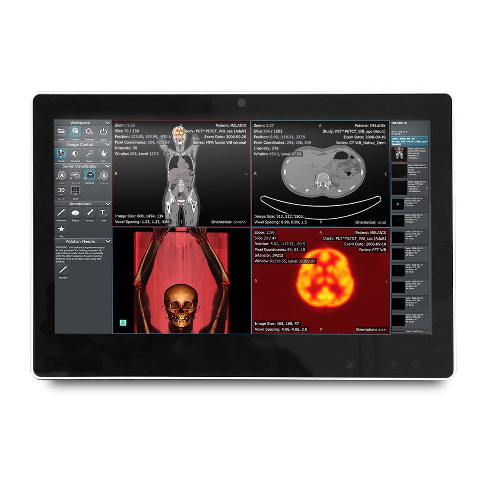 Intel® Celeron® medical panel PC - SMA-1533 - Onyx Healthcare Inc ...