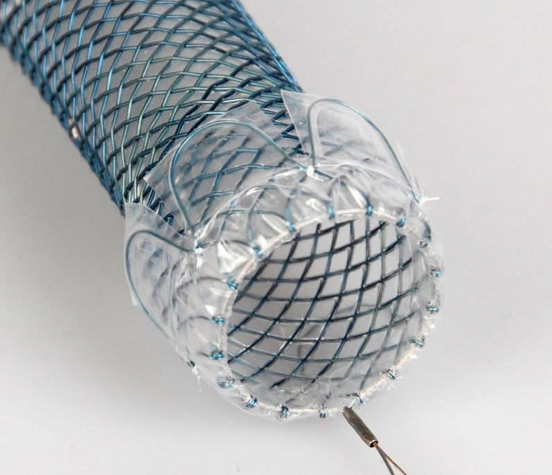 Esophageal stent HV Stent Plus ELLACS nitinol / silicone / selfexpanding