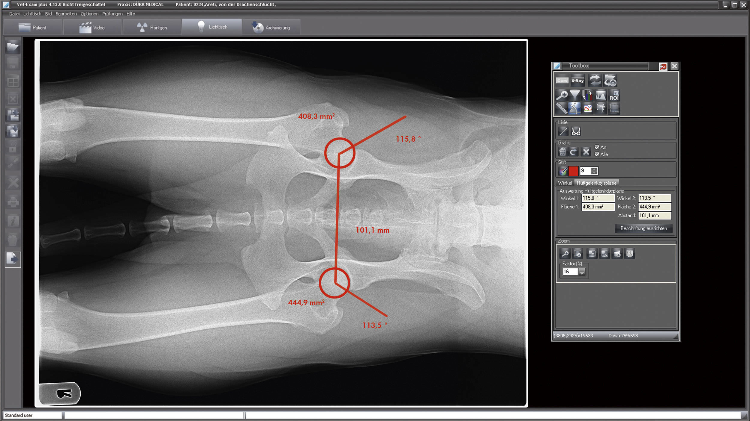 Acquisition software / for veterinary radiology / medical VETEXAM