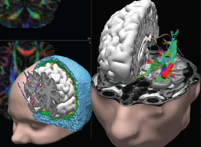 Data analysis software - CURRY 9 S - Compumedics Neuroscan - data ...