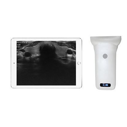 Hand-held ultrasound system - Sonostar Technologies - for multipurpose ...