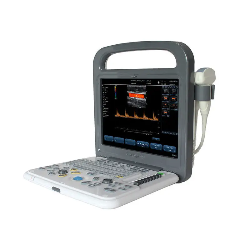 Portable ultrasound system - C8 - Sonostar Technologies - for