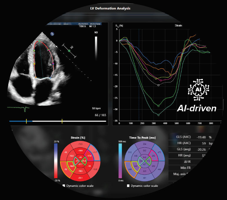 Medical software Caas Qardia Pie Medical Imaging for ultrasound