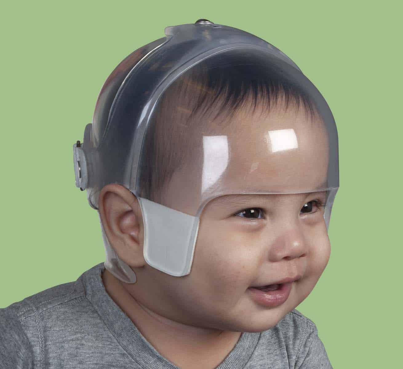 Cranial orthosis STARlight™ BiValve Orthomerica pediatric