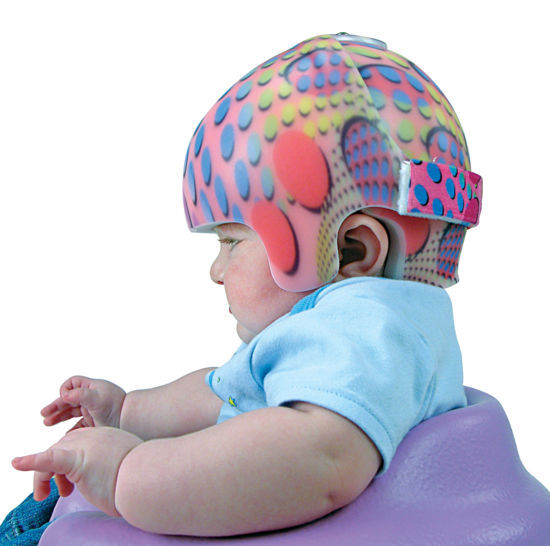 Cranial orthosis STARband BiValve Orthomerica pediatric