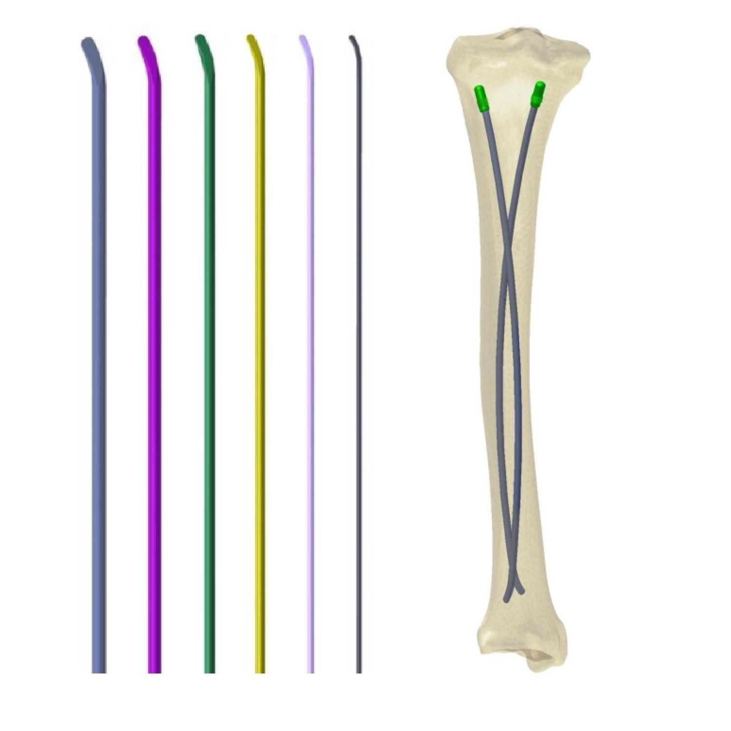 Femoral intramedullary nail - Health-Joy Medical - tibia / fibula / humerus