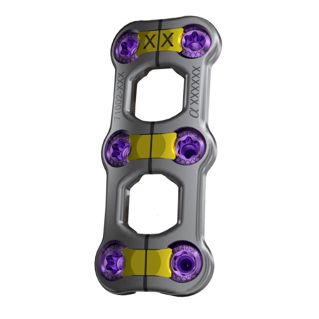 Cervical arthrodesis plate - Trestle Luxe™ - Alphatec Spine