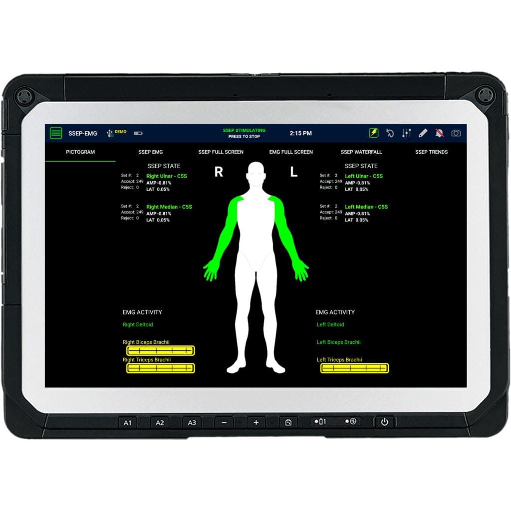 Monitoring information system SafeOp™ Alphatec Spine neurosurgery